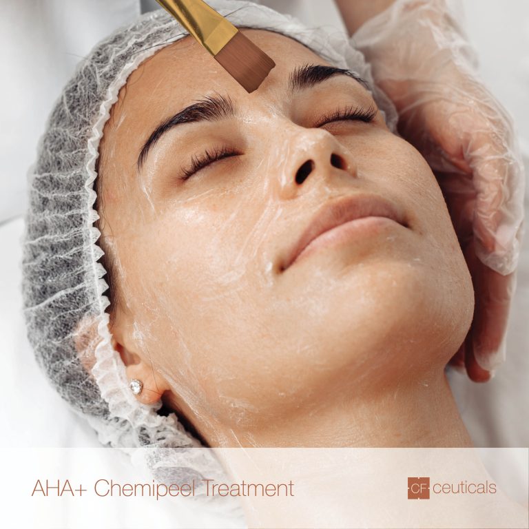 AHA+ ChemiPeel